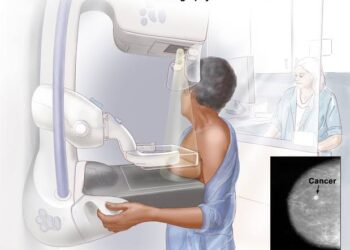 U.S panel lowers breast cancer screening age, lays emphasis on black women