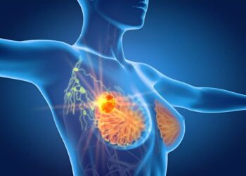 BREAST CANCER TREATMENT BREAKTHROUGH: Drug found to reduce risk of cancer coming back