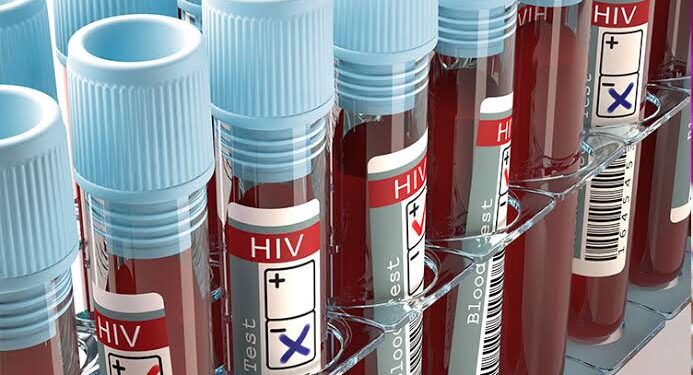 Trump: WHO raises concern on potential global threat to people living with HIV