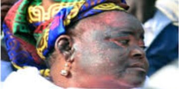 Experts to Nigerians: Skin bleaching leads to infertility, hormonal imbalance, diabetes, others