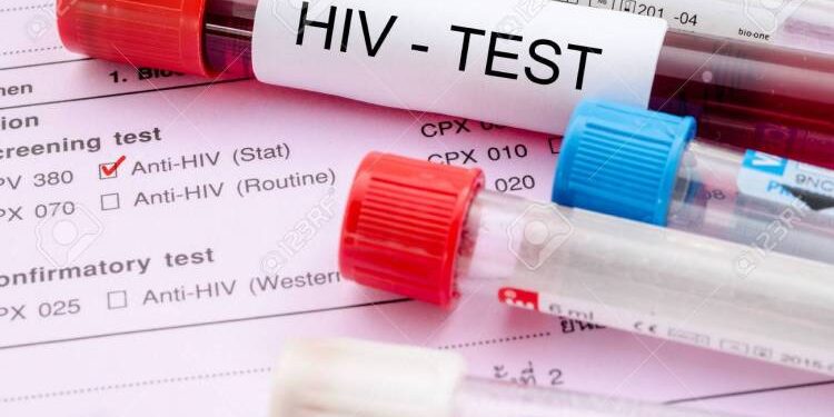 Experts hail new HIV injection breakthrough ,decry high cost