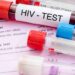 Experts hail new HIV injection breakthrough ,decry high cost