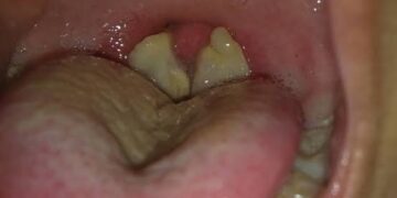 Edo confirms five diphtheria cases, two deaths