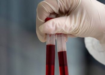 New trial raises hope of detecting over 50 cancers through blood test