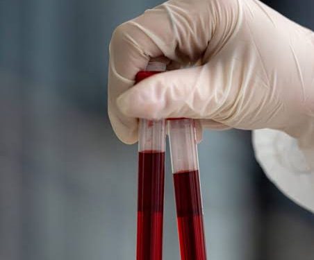 New trial raises hope of detecting over 50 cancers through blood test
