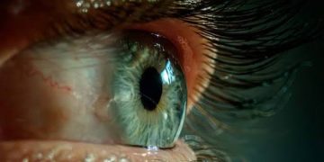 Mangal Foundation offers free surgeries to 18,000 eye patients