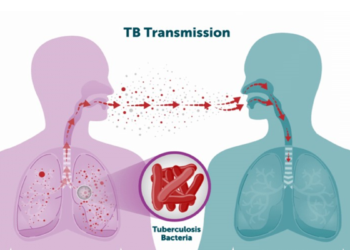 New tuberculosis vaccines to be  available from 2029- Gavi 